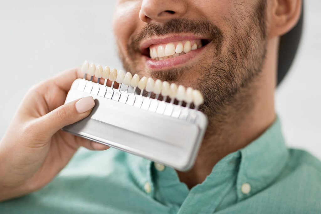 Contouring Alignment With Veneers