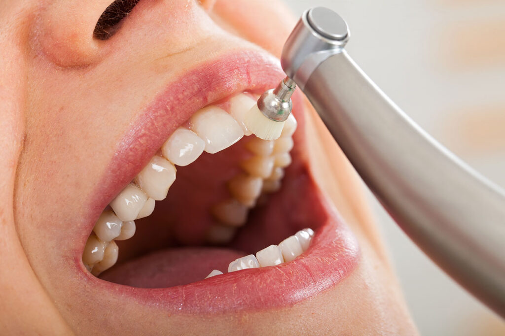 General Cosmetic Dentistry