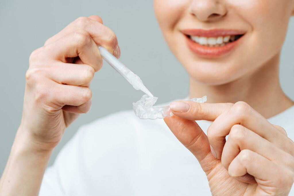 Invisalign Clear Aligners