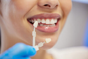 Porcelain Veneers for Smile Enhancement in Belton, MO