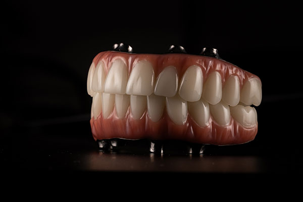 Snap-In Implant Dentures in Belton